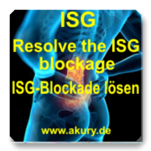 ISG ISG Blockade lösen